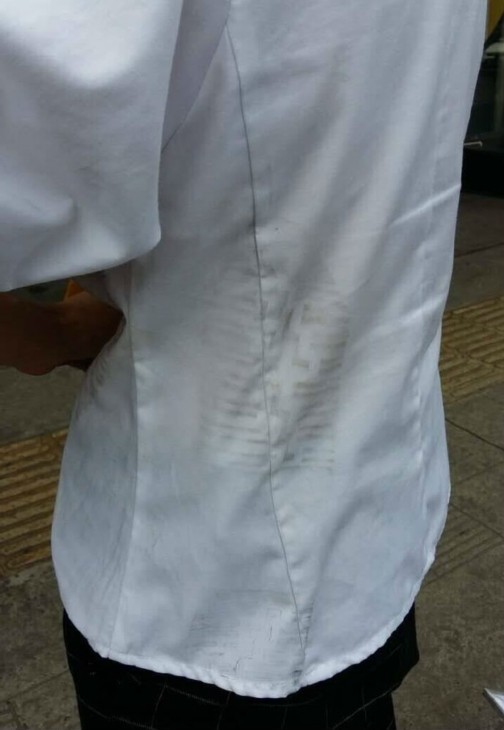 彭女士离开成美之后衣服上留有被踢的脚印